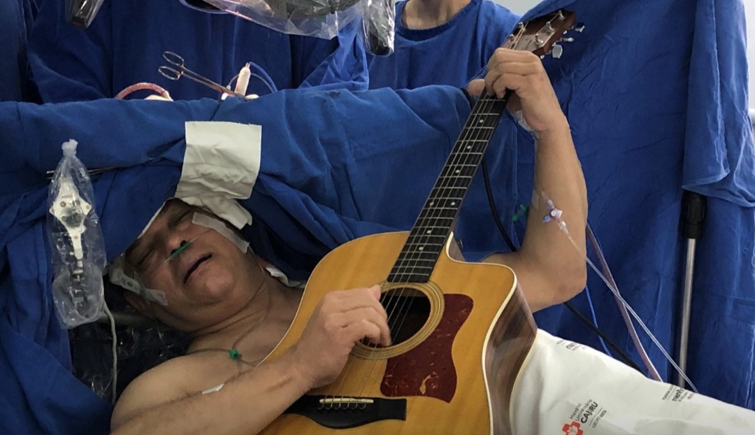 Paciente toca violão durante cirurgia de tumor cerebral em hospital no Paraná