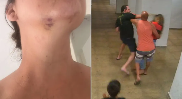 Homem agride vizinha com chute no rosto durante briga em condomínio