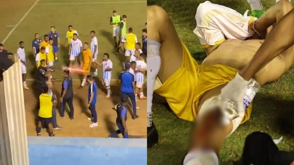 Vídeo: goleiro é baleado por PM durante confusão em partida de futebol