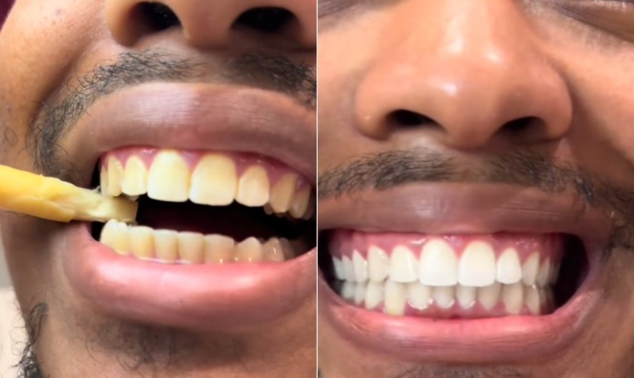 Galho de árvore se torna fenômeno no TikTok como alternativa natural para clarear dentes