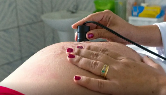 Ministério da Saúde recomenda cálcio para todas as gestantes para prevenir eclâmpsia