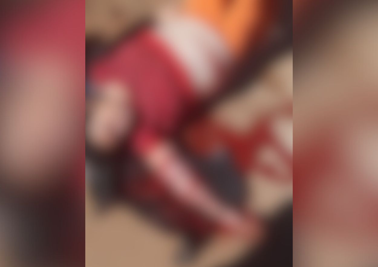 Vítima de ataque de cães em Castro teve braço amputado