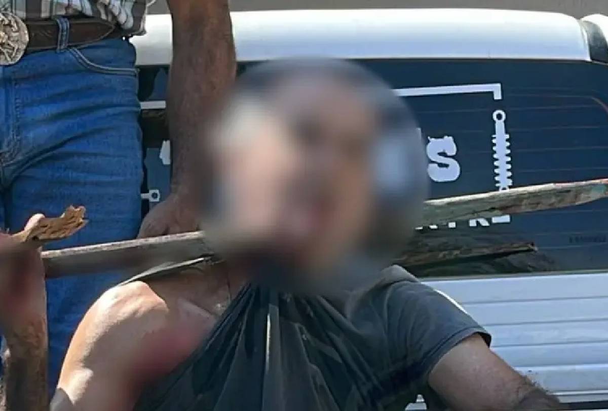 Homem com estaca no pescoço deixa a UTI