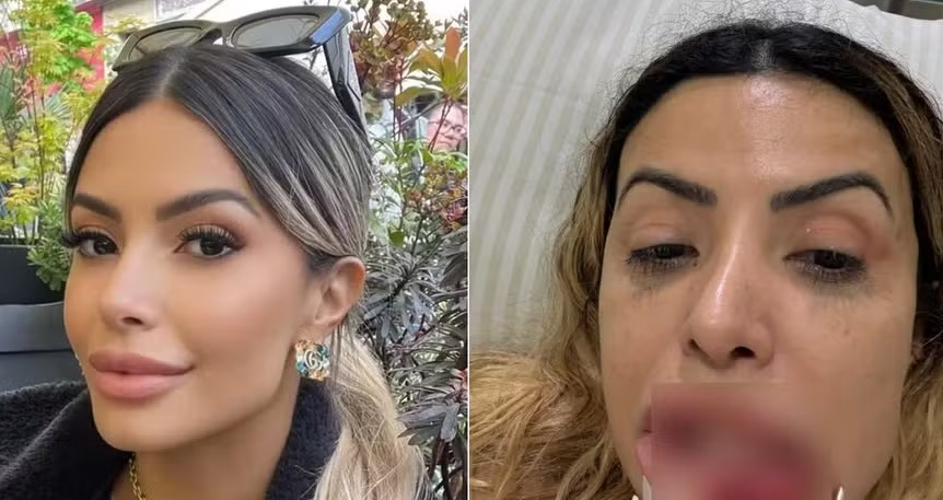 Saiba quem é a modelo conhecida como ‘mulher perfeita’ que foi espancada pelo namorado