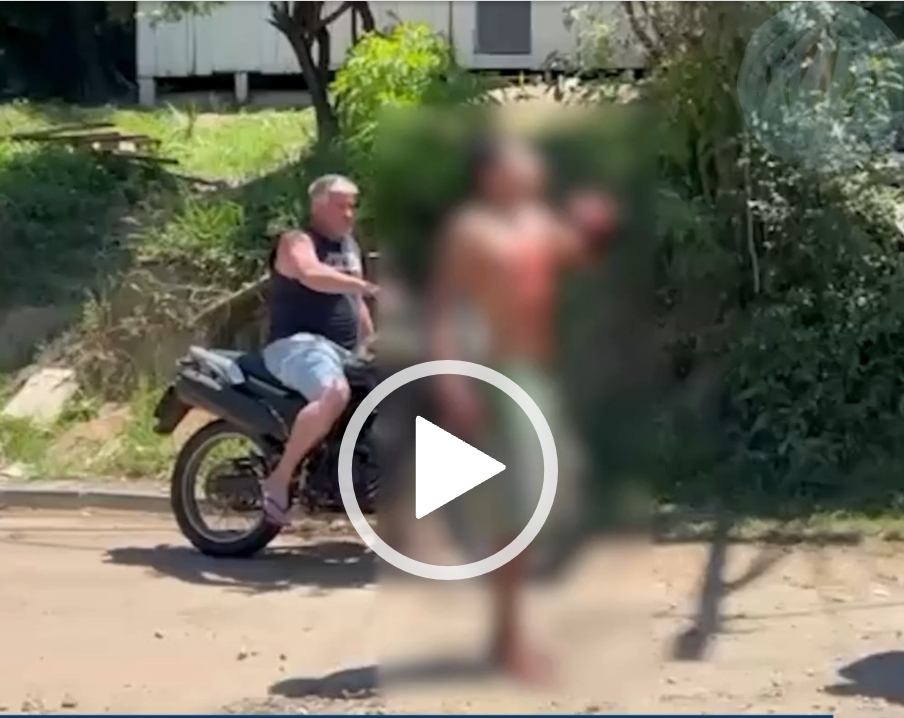 VÍDEO: GCM usa arma de eletrochoque para conter jovem em surto e com ferimentos em PG
