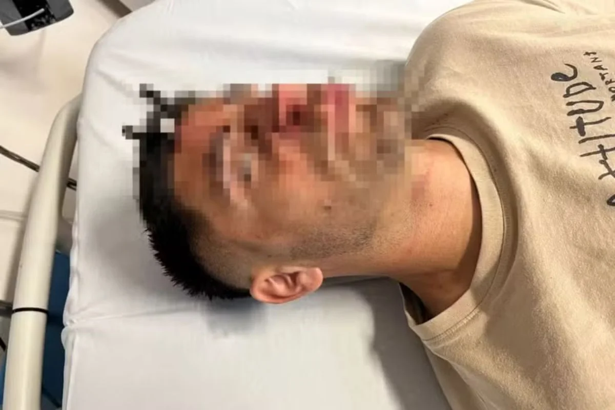 Jogador tem chave cravada na testa após briga em estádio