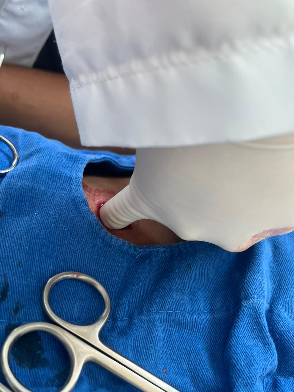 ADOLESCENTE É ESFAQUEADO NA REGIÃO CENTRAL