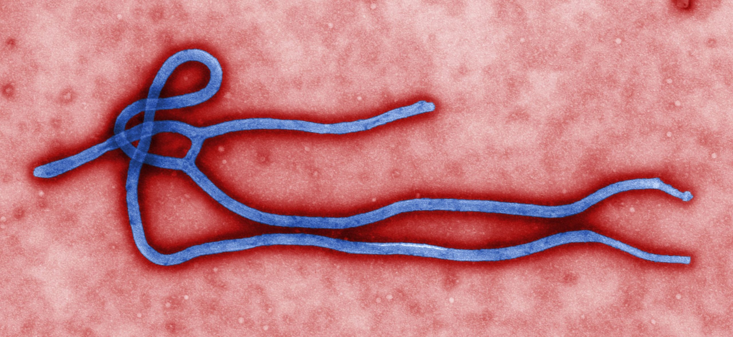 Surto de Ebola no Congo pode virar pandemia mundial?
