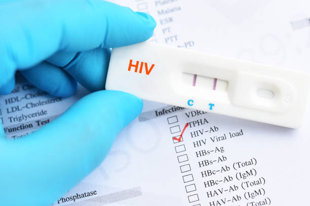 HIV: estudo aponta maioria de casos avançados entre heterossexuais com parceiro fixo