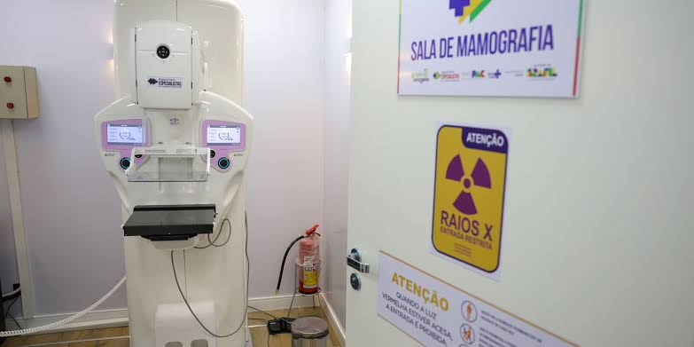 Cirurgias plásticas de mama pelo SUS crescem 54% em dez anos